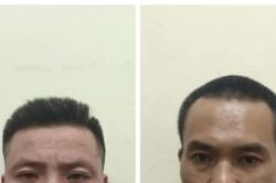 Từ một người dương t&iacute;nh ma t&uacute;y, lộ điểm tổ chức 'bay lắc'