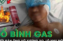 Đang ăn trưa, người đàn ông 49 tuổi bị bình gas mini bắn trúng đầu, vỡ xương sọ