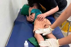 Khỉ hoang tấn công trẻ em ở biên giới Lạng Sơn