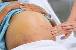 Điểm chung của những người trẻ mắc bệnh ở tuổi 20-30