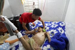 Liệt tứ chi 12 năm, chàng trai chỉ mong có tiền chữa vết loét