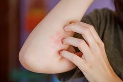 Codex ban hành hướng dẫn mới về nhãn thực phẩm cảnh báo dị ứng