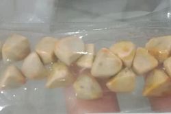 Ngày nào cũng uống trà đá, người phụ nữ đi khám mới bàng hoàng phát hiện cả 'ổ' sỏi trong cơ thể: Bác sĩ cảnh báo điều này