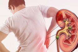 5 chỉ dấu nhận biết chức năng thận của bạn đang duy trì ổn định