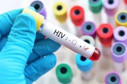 Phân cấp mạnh mẽ về thẩm quyền cấp giấy chứng nhận bị phơi nhiễm với HIV, bị nhiễm HIV do tai nạn rủi ro nghề nghiệp