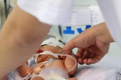 Ca phẫu thuật đặc biệt khó, cứu bé sơ sinh không hậu môn