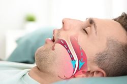 Ng&aacute;y to bị vợ giục đi kh&aacute;m, ph&aacute;t hiện căn bệnh c&oacute; thể dẫn đến đột quỵ