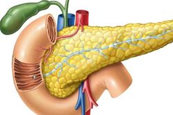 Tăng mỡ máu có thể gây viêm tụy cấp nguy hiểm đến tính mạng