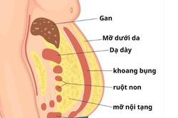 Mỡ nội tạng nguy hiểm hơn mỡ dưới da như thế nào?