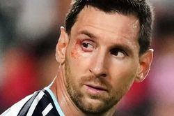 Messi bị chảy máu ngay mắt sau cú va chạm với đội trưởng Thụy Sĩ