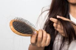 Rụng tóc lâu ngày có phải bệnh tuyến giáp?