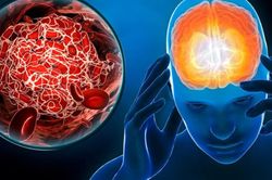 Tự ý bỏ thuốc tiểu đường, ăn kiêng, người đàn ông hôn mê vì hạ đường huyết, triệu chứng giống đột quỵ