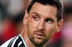 Messi rách mí mắt vì khuỷu tay Xhaka, vẫn chiến đấu đưa Argentina vào bán kết