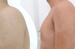 Cổ rụt, lưng gù vì ngồi học vẹo vọ, bò ra bàn
