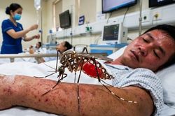 Phân biệt sốt xuất huyết và cúm mùa