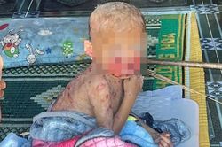 Mang 'bệnh lạ' từ lúc lọt lòng, bé trai vùng cao vẫn chưa có tiền đi chữa
