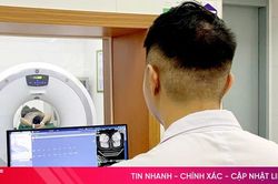 Có tiền sử hút thuốc lá, một bệnh nhân xuất hiện khối bất thường ở phổi