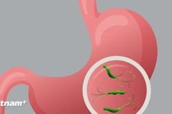Ph&aacute;t hiện chủng probiotic mới gi&uacute;p ức chế vi khuẩn HP g&acirc;y bệnh dạ d&agrave;y