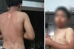 Đắk Lắk: Khẩn trương xác minh làm rõ thông tin bé trai nghi bị mẹ tạt nước sôi gây bỏng nặng