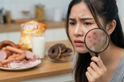 5 loại thực phẩm có thể gây hại cho làn da