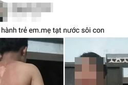 Công an vào cuộc vụ bé trai ở Đắk Lắk nghi bị mẹ tạt nước sôi