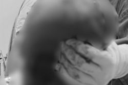 Bé gái 14 tuổi có vùng mông to bất thường, sự thật phía sau khiến gia đình 'sốc ngang'