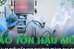 Cô gái 33 tuổi mắc ung thư trực tràng giai đoạn 3, bác sĩ nỗ lực bảo tồn hậu môn