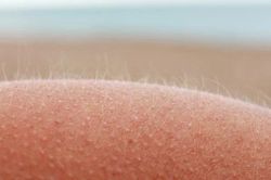 Giải mã bí ẩn trăm năm về lông tơ giúp trị chứng ngứa