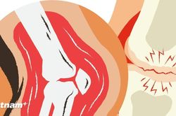 Tìm ra cơ chế gây bệnh ung thư xương hiếm gặp