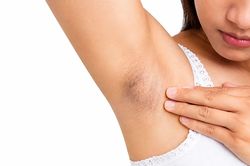 4 nguyên nhân khiến vùng da dưới cánh tay ngày càng thâm sạm, nhiều người mắc phải mà không biết