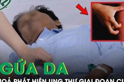 Tá hỏa phát hiện ung thư tụy giai đoạn cuối từ dấu hiệu ngứa da
