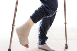 Lưu ý khi phục hồi chức năng sau gãy xương