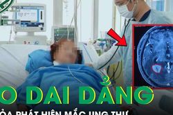 Người phụ nữ tá hỏa phát hiện mắc ung thư từ dấu hiệu ho dai dẳng