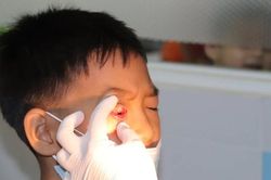 Ngành Y tế khuyến cáo chủ động phòng ngừa dịch bệnh do Adenovirus và đau mắt đỏ