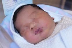Sản phụ sinh con 5,3kg: Lời cảnh báo về đái tháo đường thai kỳ mẹ bầu chớ coi thường