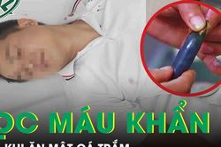 Người đàn ông 68 tuổi suy đa tạng phải lọc máu khẩn cấp sau khi ăn mật cá trắm
