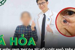 Tá hỏa phát hiện ung thư da từ vết loét nhỏ trên mặt