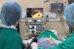 Thường xuyên ăn thịt bò tái, đi khám, người đàn ông phát hiện sán dây bò dài 1,2 mét trong ruột