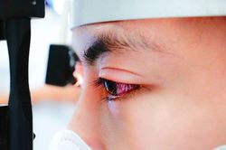 Bệnh đau mắt đỏ gia tăng, Bộ Y tế đưa ra 7 cảnh báo