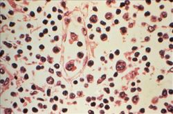 Virus Hanta: Tăng cường vệ sinh phòng ngừa nguy cơ lây nhiễm từ chuột