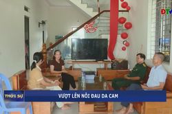 Vượt lên nỗi đau da cam