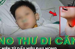 Nam sinh lớp 8 ph&aacute;t hiện ung thư di căn từ dấu hiệu đau họng