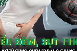 Người phụ nữ tiểu đêm liên tục, sụt 11kg vì khối u xơ tử cung chèn ép bàng quang