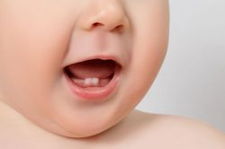 D&iacute;nh thắng lưỡi ở trẻ em