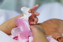 Em bé chào đời với một phần trái tim bên ngoài cơ thể