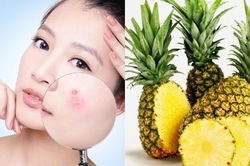 Bí quyết sở hữu làn da căng bóng, mịn màng chỉ nhờ một quả dứa