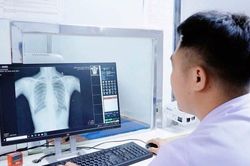 Hơn 3.000 người dân được khám sàng lọc bệnh hô hấp miễn phí