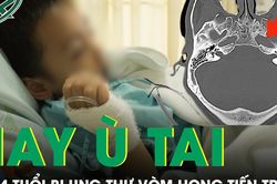Bé trai 14 tuổi liên tục ù tai, bác sĩ phát hiện ung thư vòm mũi họng giai đoạn tiến triển