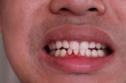 4 dấu hiệu gan đang 'kêu cứu' biểu hiện trên mặt