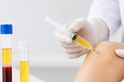 Điều trị thoái hóa khớp gối bằng huyết tương giàu tiểu cầu là gì?